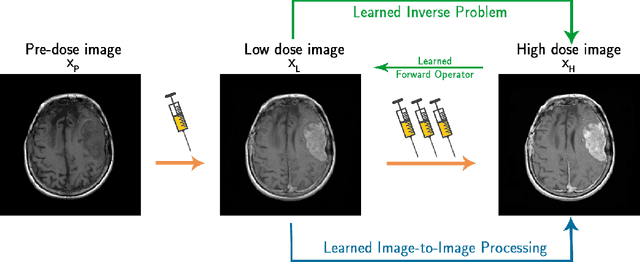 Figure 3 for LIP-CAR: contrast agent reduction by a deep learned inverse problem