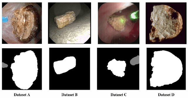 Figure 3 for Assessing the generalization performance of SAM for ureteroscopy scene understanding