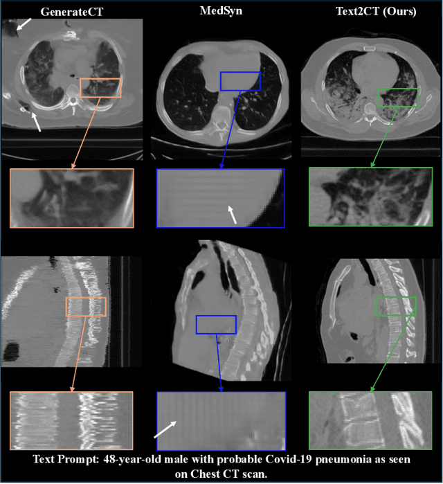 Figure 1 for Text2CT: Towards 3D CT Volume Generation from Free-text Descriptions Using Diffusion Model