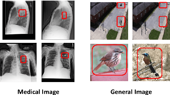 Figure 1 for Inquire, Interact, and Integrate: A Proactive Agent Collaborative Framework for Zero-Shot Multimodal Medical Reasoning