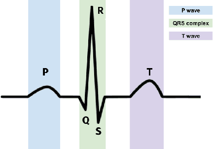 Figure 1 for Self-Trained Model for ECG Complex Delineation