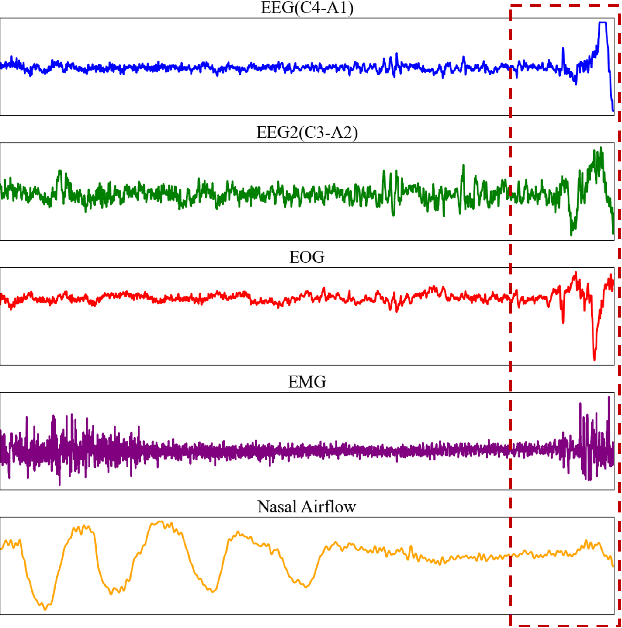 Figure 1 for PSG-MAE: Robust Multitask Sleep Event Monitoring using Multichannel PSG Reconstruction and Inter-channel Contrastive Learning