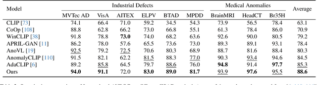Figure 4 for Towards Zero-Shot Anomaly Detection and Reasoning with Multimodal Large Language Models