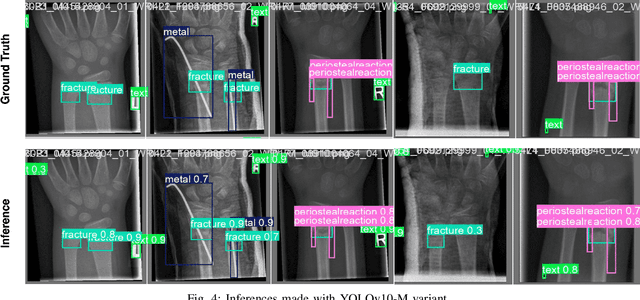 Figure 4 for Pediatric Wrist Fracture Detection in X-rays via YOLOv10 Algorithm and Dual Label Assignment System