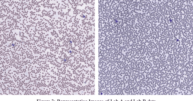 Figure 4 for Stain Normalization of Hematology Slides using Neural Color Transfer