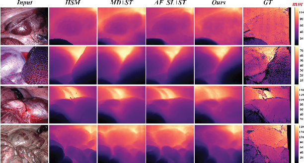 Figure 3 for Distilled Visual and Robot Kinematics Embeddings for Metric Depth Estimation in Monocular Scene Reconstruction