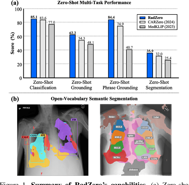 Figure 1 for RadZero: Similarity-Based Cross-Attention for Explainable Vision-Language Alignment in Radiology with Zero-Shot Multi-Task Capability
