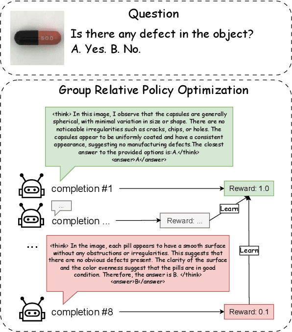 Figure 1 for AnomalyR1: A GRPO-based End-to-end MLLM for Industrial Anomaly Detection