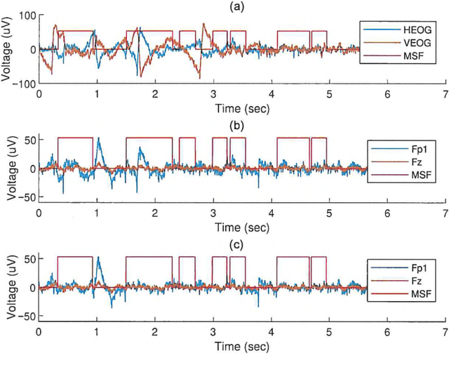 Figure 3 for Implementation of tools for lessening the influence of artifacts in EEG signal analysis