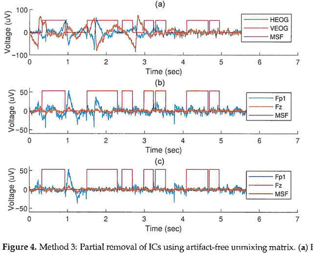 Figure 4 for Implementation of tools for lessening the influence of artifacts in EEG signal analysis