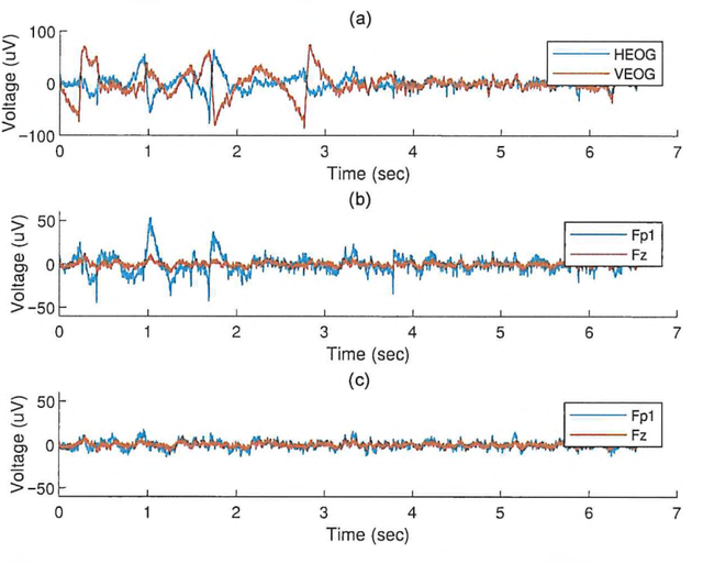 Figure 1 for Implementation of tools for lessening the influence of artifacts in EEG signal analysis