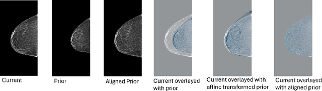 Figure 3 for Reconsidering Explicit Longitudinal Mammography Alignment for Enhanced Breast Cancer Risk Prediction