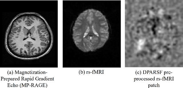 Figure 4 for Improving Brain Disorder Diagnosis with Advanced Brain Function Representation and Kolmogorov-Arnold Networks