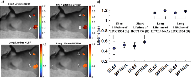 Figure 4 for Enhancing Fluorescence Lifetime Parameter Estimation Accuracy with Differential Transformer Based Deep Learning Model Incorporating Pixelwise Instrument Response Function