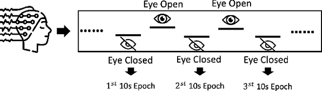 Figure 1 for Flexible and Explainable Graph Analysis for EEG-based Alzheimer's Disease Classification