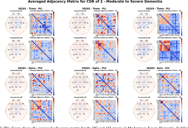 Figure 3 for Flexible and Explainable Graph Analysis for EEG-based Alzheimer's Disease Classification