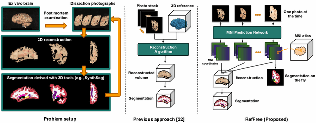Figure 1 for Reference-Free 3D Reconstruction of Brain Dissection Photographs with Machine Learning