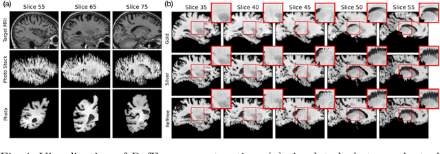 Figure 4 for Reference-Free 3D Reconstruction of Brain Dissection Photographs with Machine Learning