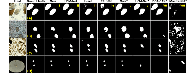Figure 2 for Copy-Move Detection in Optical Microscopy: A Segmentation Network and A Dataset