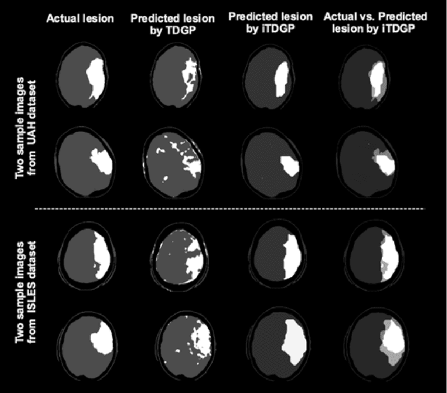 Figure 3 for Ischemic Stroke Lesion Prediction using imbalanced Temporal Deep Gaussian Process (iTDGP)