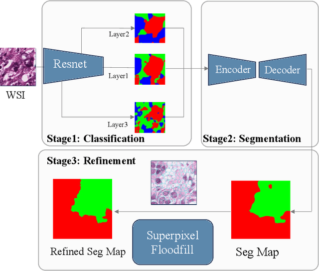 Figure 1 for Superpixel Boundary Correction for Weakly-Supervised Semantic Segmentation on Histopathology Images