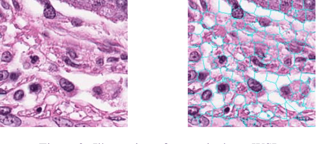 Figure 3 for Superpixel Boundary Correction for Weakly-Supervised Semantic Segmentation on Histopathology Images
