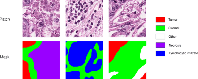 Figure 4 for Superpixel Boundary Correction for Weakly-Supervised Semantic Segmentation on Histopathology Images