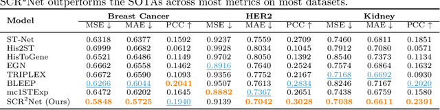 Figure 2 for SCR2-ST: Combine Single Cell with Spatial Transcriptomics for Efficient Active Sampling via Reinforcement Learning