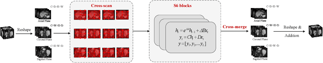 Figure 2 for SRMA-Mamba: Spatial Reverse Mamba Attention Network for Pathological Liver Segmentation in MRI Volumes