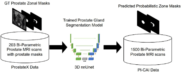 Figure 1 for Prostate Lesion Estimation using Prostate Masks from Biparametric MRI
