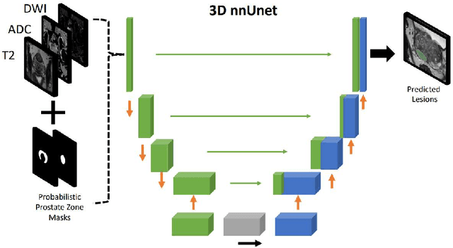 Figure 3 for Prostate Lesion Estimation using Prostate Masks from Biparametric MRI