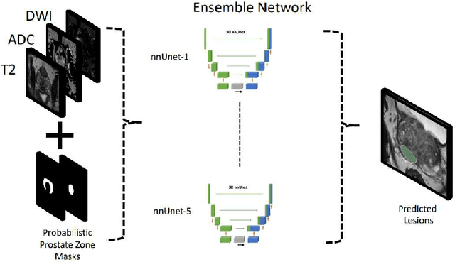 Figure 4 for Prostate Lesion Estimation using Prostate Masks from Biparametric MRI