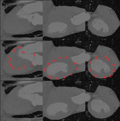 Figure 1 for Synthetic Data Generation for 3D Myocardium Deformation Analysis
