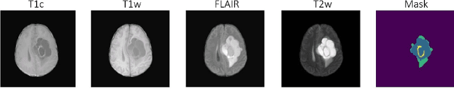 Figure 1 for Parameter-efficient Fine-tuning for improved Convolutional Baseline for Brain Tumor Segmentation in Sub-Saharan Africa Adult Glioma Dataset