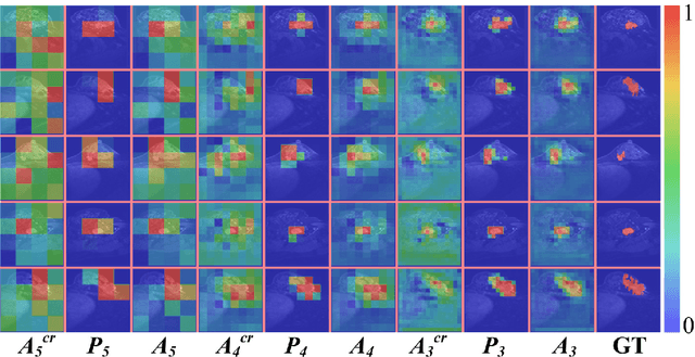 Figure 2 for Progressive Dual Priori Network for Generalized Breast Tumor Segmentation