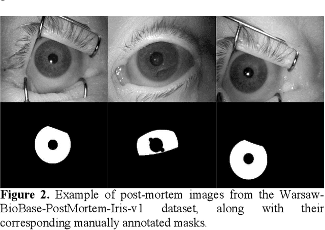 Figure 3 for Post-Mortem Human Iris Segmentation Analysis with Deep Learning