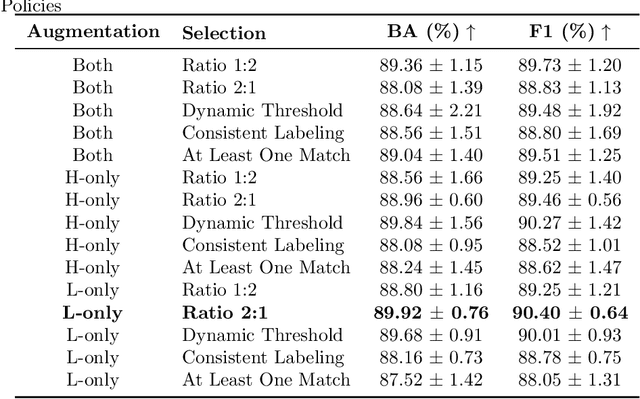 Figure 2 for Uncertainty Aware Human-machine Collaboration in Camouflaged Object Detection
