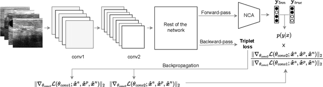 Figure 3 for On dataset transferability in medical image classification