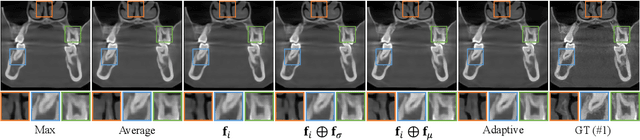 Figure 2 for Geometry-Aware Attenuation Field Learning for Sparse-View CBCT Reconstruction