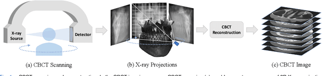 Figure 1 for Geometry-Aware Attenuation Field Learning for Sparse-View CBCT Reconstruction