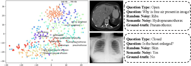 Figure 3 for DiN: Diffusion Model for Robust Medical VQA with Semantic Noisy Labels
