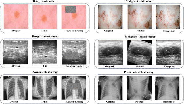 Figure 1 for BayTTA: Uncertainty-aware medical image classification with optimized test-time augmentation using Bayesian model averaging