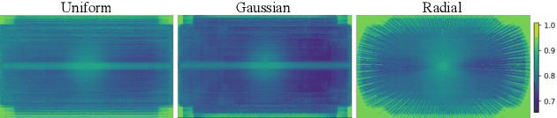 Figure 2 for SDUM: A Scalable Deep Unrolled Model for Universal MRI Reconstruction