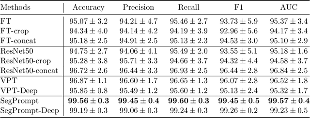 Figure 2 for SegPrompt: Using Segmentation Map as a Better Prompt to Finetune Deep Models for Kidney Stone Classification