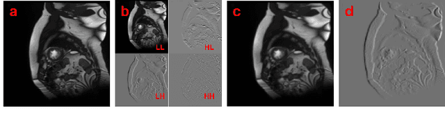 Figure 1 for WT-BCP: Wavelet Transform based Bidirectional Copy-Paste for Semi-Supervised Medical Image Segmentation