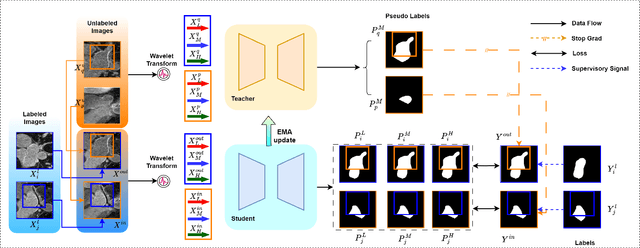Figure 2 for WT-BCP: Wavelet Transform based Bidirectional Copy-Paste for Semi-Supervised Medical Image Segmentation
