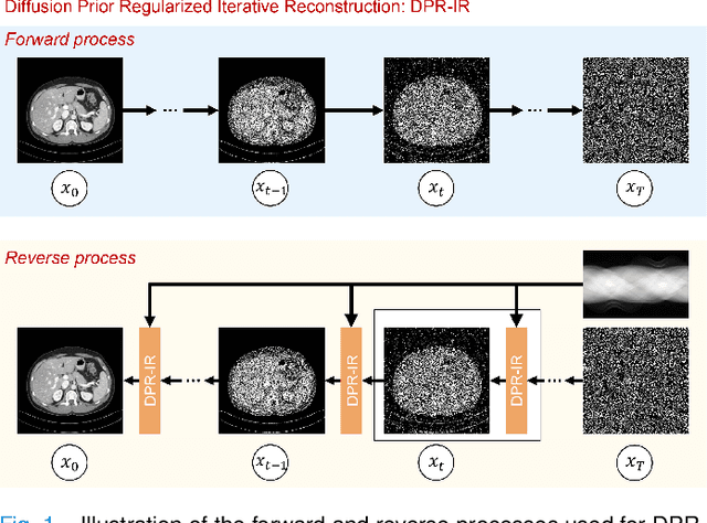 Figure 1 for Diffusion Prior Regularized Iterative Reconstruction for Low-dose CT