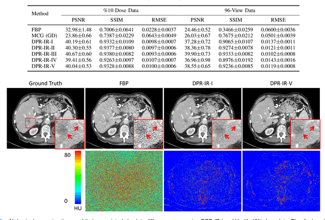 Figure 2 for Diffusion Prior Regularized Iterative Reconstruction for Low-dose CT