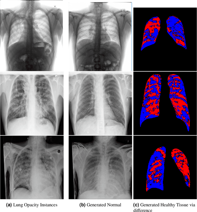 Figure 3 for VALD-MD: Visual Attribution via Latent Diffusion for Medical Diagnostics