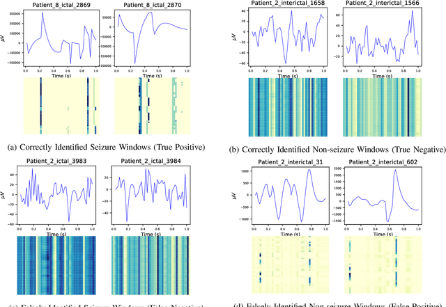 Figure 2 for Unsupervised Multivariate Time-Series Transformers for Seizure Identification on EEG
